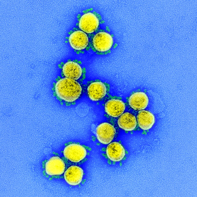 Coronavirus - Covid-19