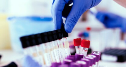 Una persona que lleva guantes azules ordena tubos de muestras de sangre etiquetados en un laboratorio, lo que supone un apoyo fundamental para los abogados de Chicago en sus litigios.