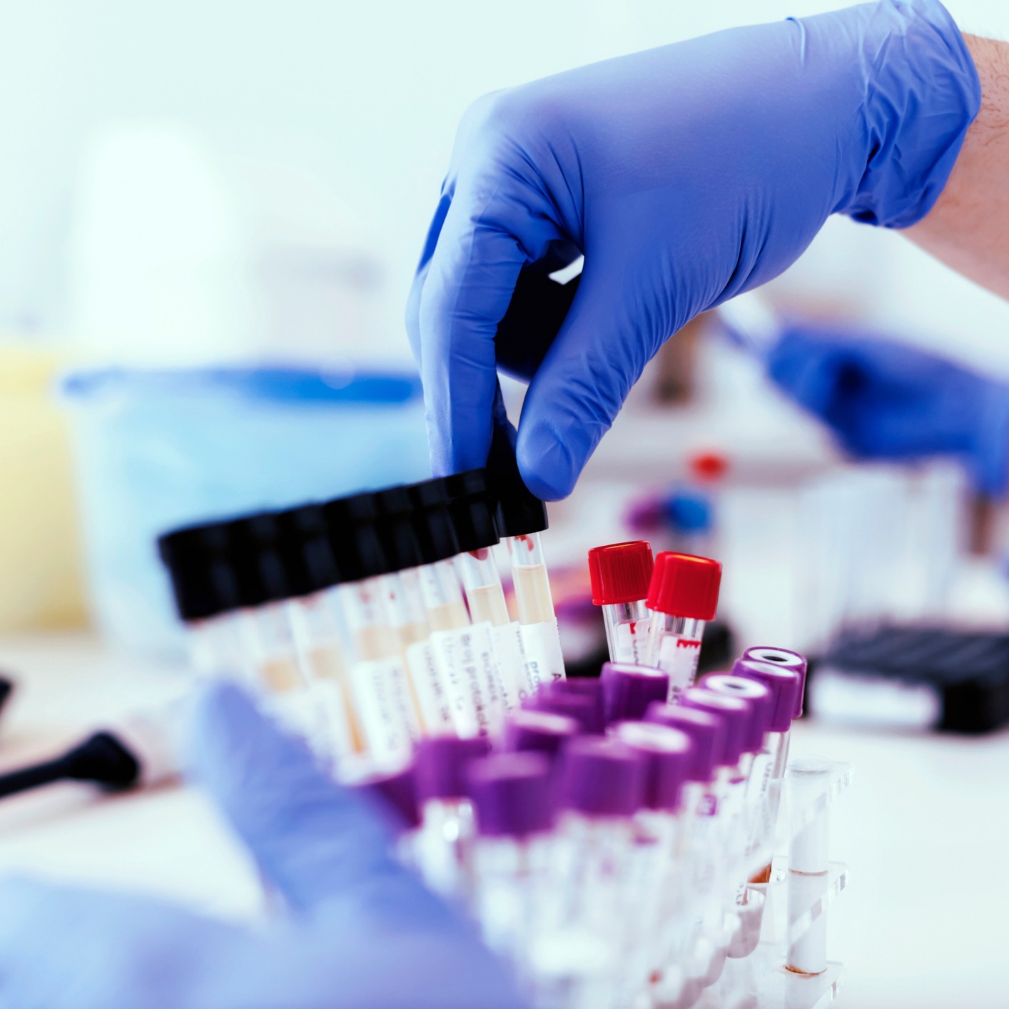 A person wearing blue gloves arranges labeled blood sample tubes in a laboratory setting, providing crucial litigation support for lawyers in Chicago.