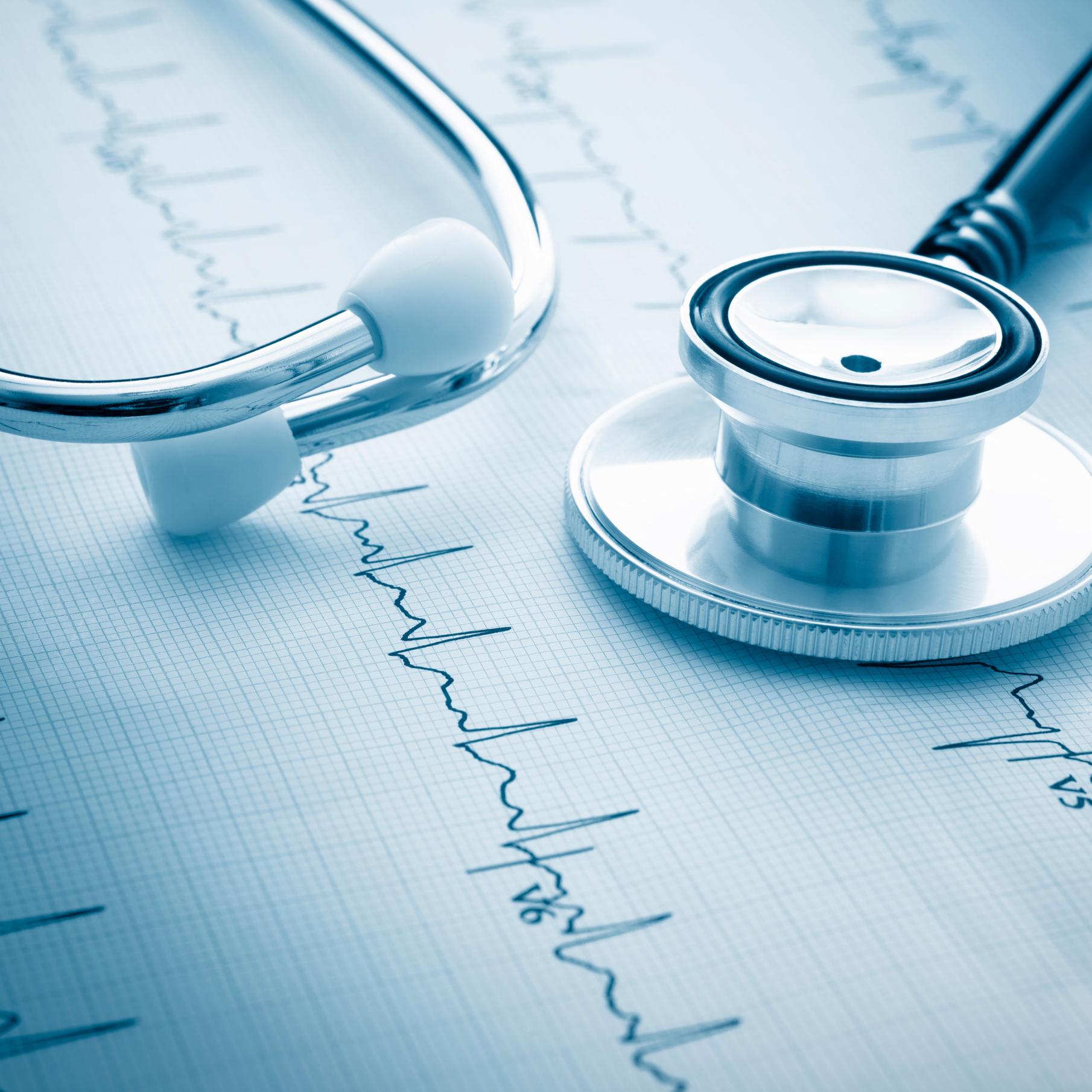 A stethoscope rests on a printed electrocardiogram (ECG) graph displaying heart rhythm patterns, capturing a scene reminiscent of precision often found in a corporate law office.